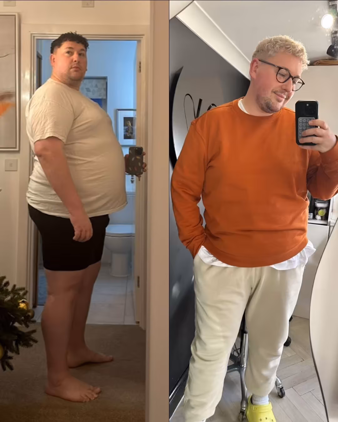 Före och efter viktminskning