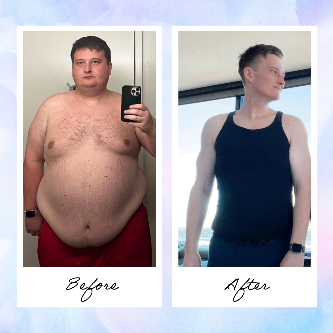 Före och efter viktminskning