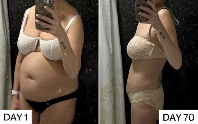 Före och efter viktminskning